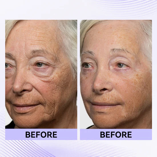 Loréno Instant Lift & Firm Cream