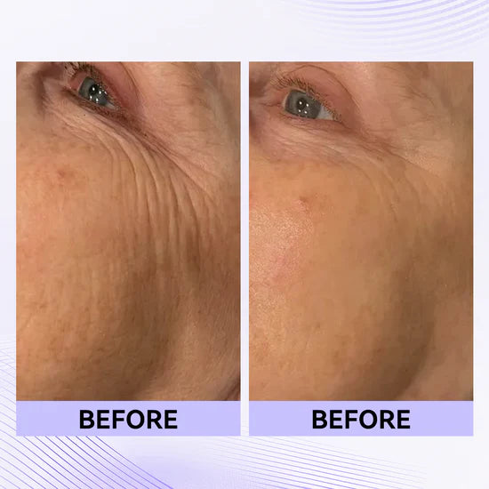 Loréno Instant Lift & Firm Cream