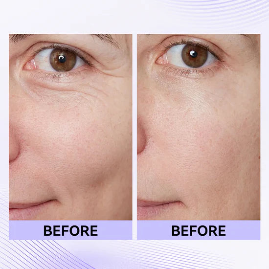 Loréno Instant Lift & Firm Cream
