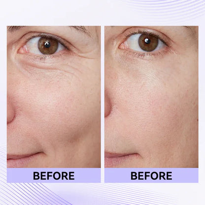 Loréno Instant Lift & Firm Cream
